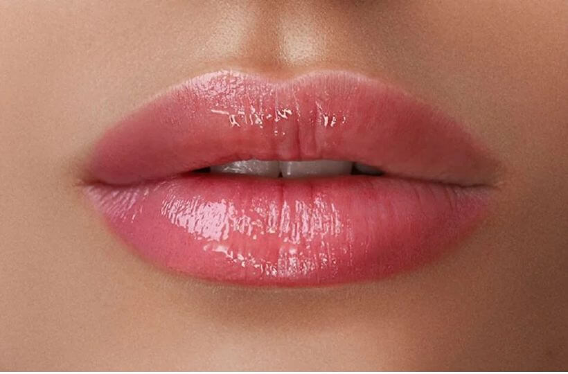 Tratamento com Ácido Hialurônico - Preenchimento Facial